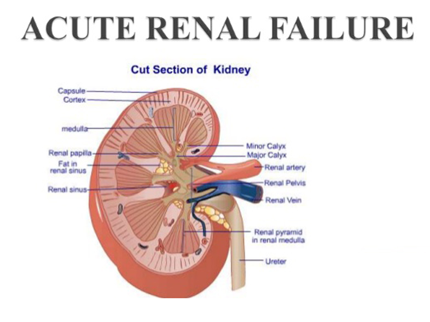 acute-renal-failure-causes-and-symptoms